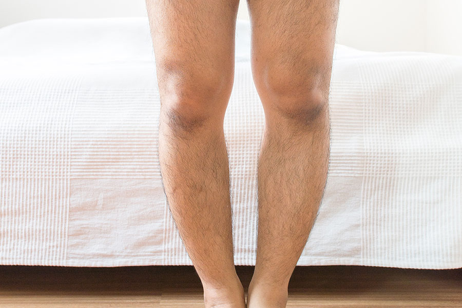 Detalhe de perna de homem com joelho valgo em frente a sua cama
