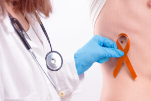 Médica segurando um laço laranja sob a pele de um homem que tem uma mancha que pode ser câncer de pele