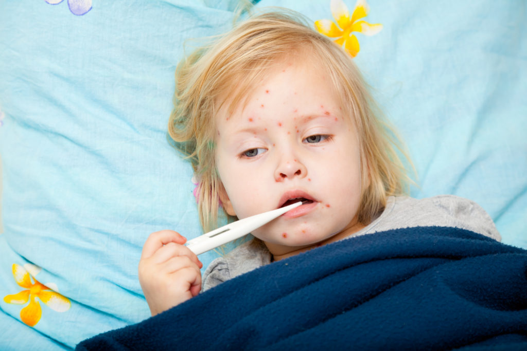 Criança com sarampo deitada na cama com termômetro