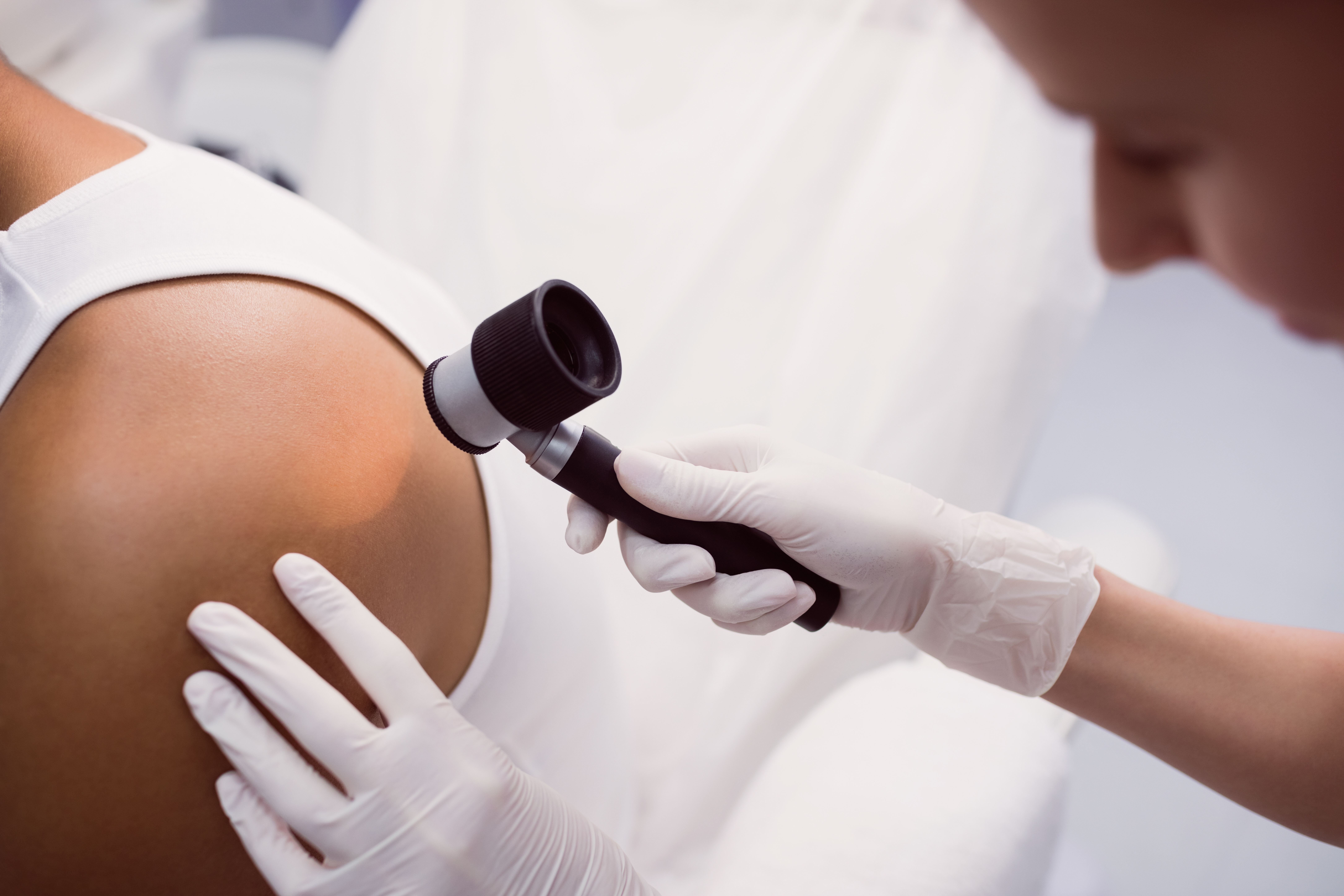Doctor removing mole with laser treatment in clinic
